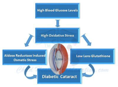 http://www.childhealth-explanation.com/images/diabetic-caatract.jpg