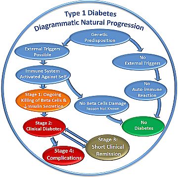 Type 1 Diabetes T1D progresses through 4 stages.