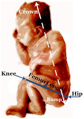 I Am 34 Weeks Pregnant My Baby Is 30 In Length From Head To Toe Is This Normal I Am 34 Weeks Pregnant My Baby Is 30 In Length From Head To Toe Is This Normal