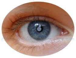 Cataract is Opacification of the Eye Lens